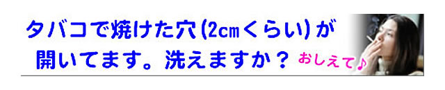 質問の内容：タバコで焼いた穴が開いていますが、クリーニングを受け付けてくれますか？